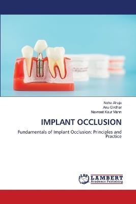 Implant Occlusion - Neha Ahuja,Anu Girdhar,Navneet Kaur Mann - cover