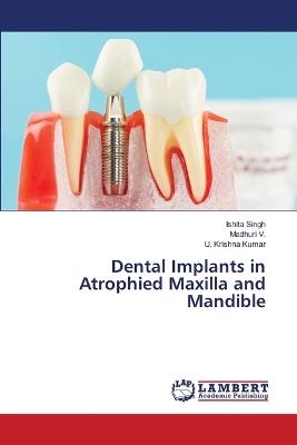 Dental Implants in Atrophied Maxilla and Mandible - Ishita Singh,Madhuri V,U Krishna Kumar - cover