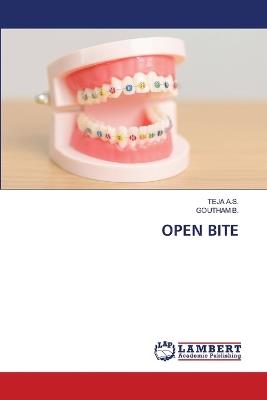 Open Bite - Teja A S,Goutham B - cover