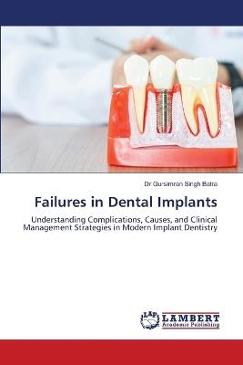 Failures in Dental Implants - Gursimran Singh Batra - cover