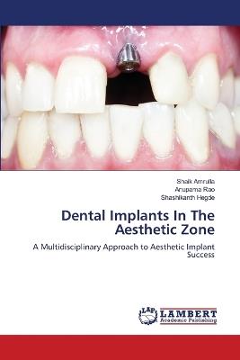 Dental Implants In The Aesthetic Zone - Shaik Amrulla,Anupama Rao,Shashikanth Hegde - cover