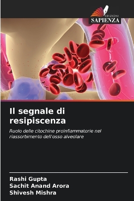 ibs