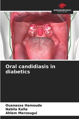 Oral candidiasis in diabetics - Ouanassa Hamouda,Nabila Kalla,Ahlem Merzougui - cover
