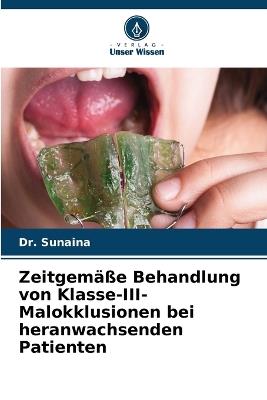 Zeitgemäße Behandlung von Klasse-III-Malokklusionen bei heranwachsenden Patienten - Sunaina - cover