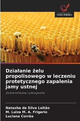 Dzialanie zelu propolisowego w leczeniu protetycznego zapalenia jamy ustnej - Natasha Da Silva Leitão,M Luiza M A Frigerio,Luciana Corrêa - cover