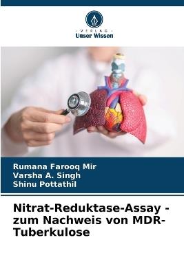 Nitrat-Reduktase-Assay - zum Nachweis von MDR-Tuberkulose - Rumana Farooq Mir,Varsha A Singh,Shinu Pottathil - cover