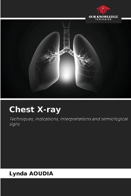 Chest X-ray - Lynda Aoudia - cover