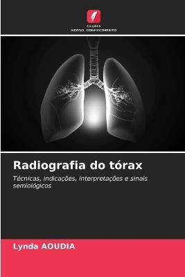 Radiografia do tórax - Lynda Aoudia - cover