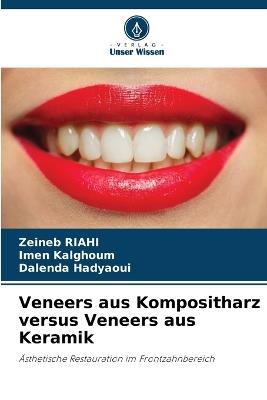 Veneers aus Kompositharz versus Veneers aus Keramik - Zeineb Riahi,Imen Kalghoum,Dalenda Hadyaoui - cover