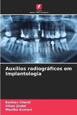 Auxílios radiográficos em Implantologia - Keshav Chand,Vikas Jindal,Monika Kumari - cover