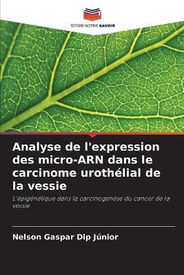 Analyse de l'expression des micro-ARN dans le carcinome urothélial de la vessie - Nelson Gaspar Dip Júnior - cover