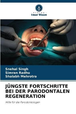 Jüngste Fortschritte Bei Der Parodontalen Regeneration - Snehal Singh,Simran Radhu,Shalabh Mehrotra - cover