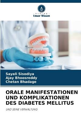 Orale Manifestationen Und Komplikationen Des Diabetes Mellitus - Sayali Sisodiya,Ajay Bhoosreddy,Chetan Bhadage - cover