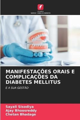 Manifestações Orais E Complicações Da Diabetes Mellitus - Sayali Sisodiya,Ajay Bhoosreddy,Chetan Bhadage - cover