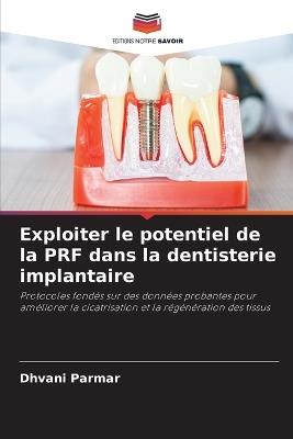 Exploiter le potentiel de la PRF dans la dentisterie implantaire - Dhvani Parmar - cover