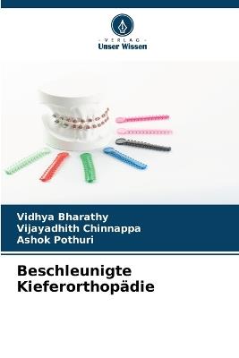 Beschleunigte Kieferorthopädie - Vidhya Bharathy,Vijayadhith Chinnappa,Ashok Pothuri - cover