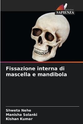 Fissazione interna di mascella e mandibola - Shweta Nehe,Manisha Solanki,Kishan Kumar - cover