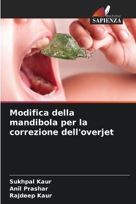 Modifica della mandibola per la correzione dell'overjet - Sukhpal Kaur,Anil Prashar,Rajdeep Kaur - cover