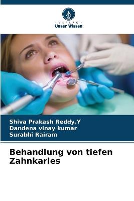 Behandlung von tiefen Zahnkaries - Shiva Prakash Reddy Y,Dandena Vinay Kumar,Surabhi Rairam - cover
