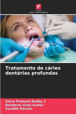 Tratamento de cáries dentárias profundas - Shiva Prakash Reddy Y,Dandena Vinay Kumar,Surabhi Rairam - cover