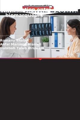 Ibd: étude de la corrélation entre certains biomarqueurs - Romany Thabet,Anfal Marzouq Alanazi,Habibah Taleb Alruwaili - cover