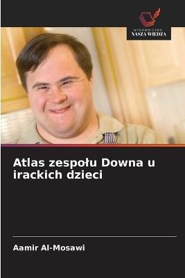 Atlas zespolu Downa u irackich dzieci - Aamir Al-Mosawi - cover