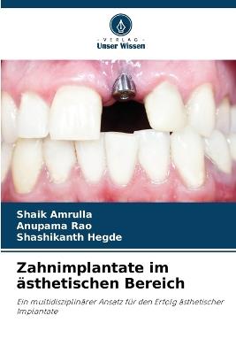Zahnimplantate im ästhetischen Bereich - Shaik Amrulla,Anupama Rao,Shashikanth Hegde - cover