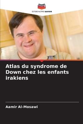 Atlas du syndrome de Down chez les enfants irakiens - Aamir Al-Mosawi - cover