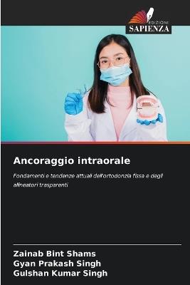 Ancoraggio intraorale - Zainab Bint Shams,Gyan Prakash Singh,Gulshan Kumar Singh - cover