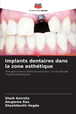 Implants dentaires dans la zone esthétique - Shaik Amrulla,Anupama Rao,Shashikanth Hegde - cover