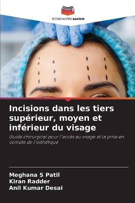 Incisions dans les tiers supérieur, moyen et inférieur du visage - Meghana S Patil,Kiran Radder,Anil Kumar Desai - cover