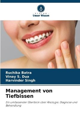 Management von Tiefbissen - Ruchika Batra,Vinay S Dua,Harvinder Singh - cover