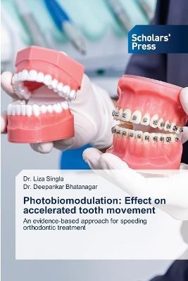 Photobiomodulation: Effect on accelerated tooth movement - Liza Singla,Deepankar Bhatanagar - cover