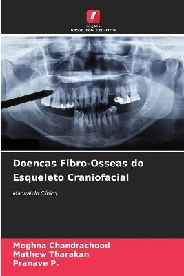 Doenças Fibro-Osseas do Esqueleto Craniofacial - Meghna Chandrachood,Mathew Tharakan,Pranave P - cover