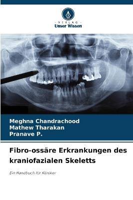 Fibro-ossäre Erkrankungen des kraniofazialen Skeletts - Meghna Chandrachood,Mathew Tharakan,Pranave P - cover