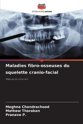Maladies fibro-osseuses du squelette cranio-facial - Meghna Chandrachood,Mathew Tharakan,Pranave P - cover