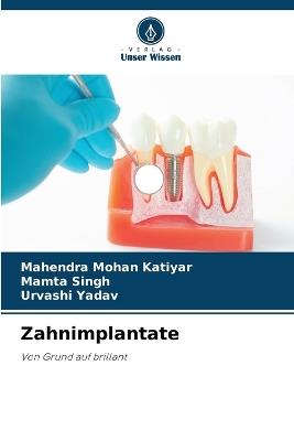 Zahnimplantate - Mahendra Mohan Katiyar,Mamta Singh,Urvashi Yadav - cover