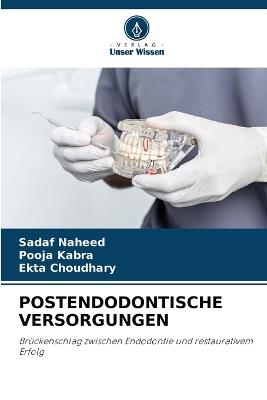 Postendodontische Versorgungen - Sadaf Naheed,Pooja Kabra,Ekta Choudhary - cover