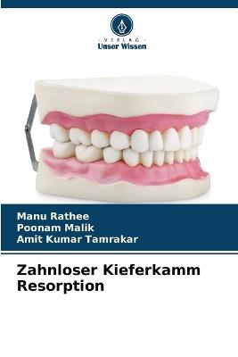 Zahnloser Kieferkamm Resorption - Manu Rathee,Poonam Malik,Amit Kumar Tamrakar - cover