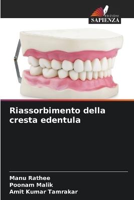 Riassorbimento della cresta edentula - Manu Rathee,Poonam Malik,Amit Kumar Tamrakar - cover