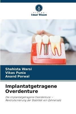 Implantatgetragene Overdenture - Shahista Warsi,Vikas Punia,Anand Porwal - cover