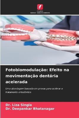Fotobiomodulação: Efeito na movimentação dentária acelerada - Liza Singla,Deepankar Bhatanagar - cover
