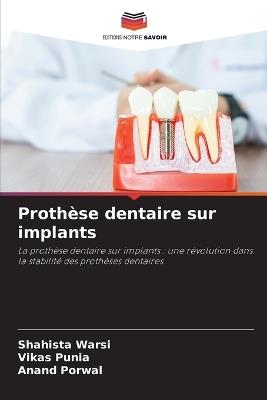 Prothèse dentaire sur implants - Shahista Warsi,Vikas Punia,Anand Porwal - cover