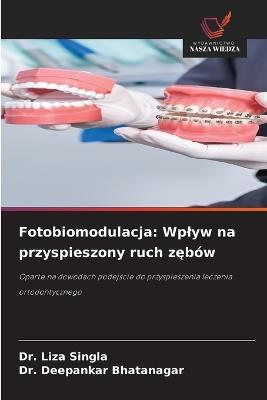 Fotobiomodulacja: Wplyw na przyspieszony ruch zębów - Liza Singla,Deepankar Bhatanagar - cover