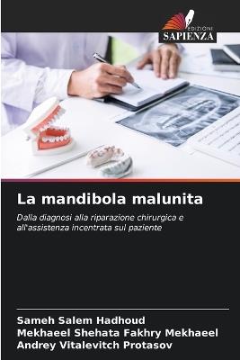 La mandibola malunita - Sameh Salem Hadhoud,Mekhaeel Shehata Fakhry Mekhaeel,Andrey Vitalevitch Protasov - cover