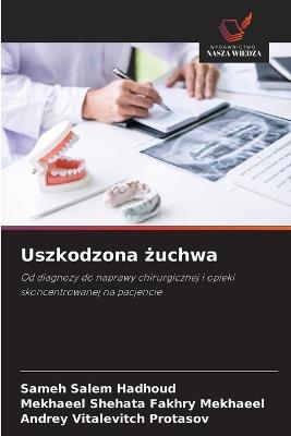 Uszkodzona żuchwa - Sameh Salem Hadhoud,Mekhaeel Shehata Fakhry Mekhaeel,Andrey Vitalevitch Protasov - cover