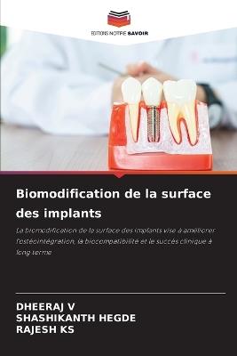 Biomodification de la surface des implants - Dheeraj V,Shashikanth Hegde,Rajesh Ks - cover