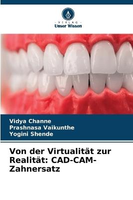 Von der Virtualität zur Realität: CAD-CAM-Zahnersatz - Vidya Channe,Prashnasa Vaikunthe,Yogini Shende - cover