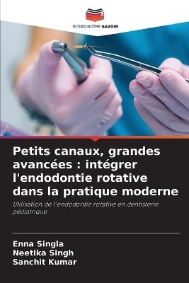 Petits canaux, grandes avancées: intégrer l'endodontie rotative dans la pratique moderne - Enna Singla,Neetika Singh,Sanchit Kumar - cover