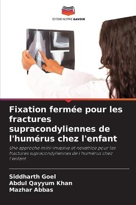 Fixation fermée pour les fractures supracondyliennes de l'humérus chez l'enfant - Siddharth Goel,Abdul Qayyum Khan,Mazhar Abbas - cover